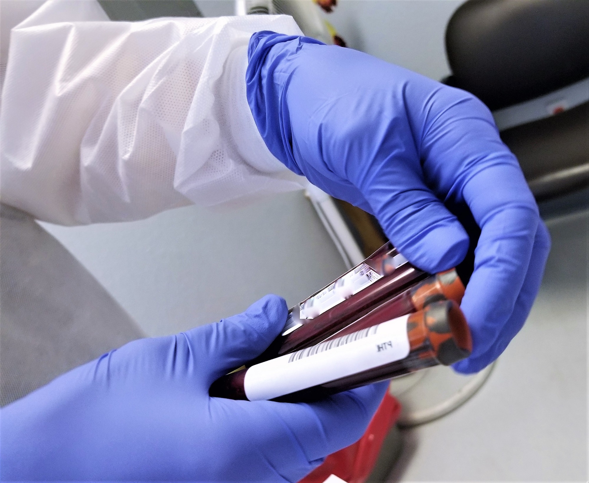 What Lab Tests Can I Do at Home? - Health Tips | Health Blog | Health ...